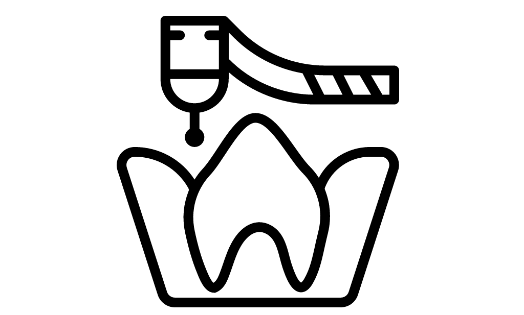 Корневые каналы |Восстановление зубов