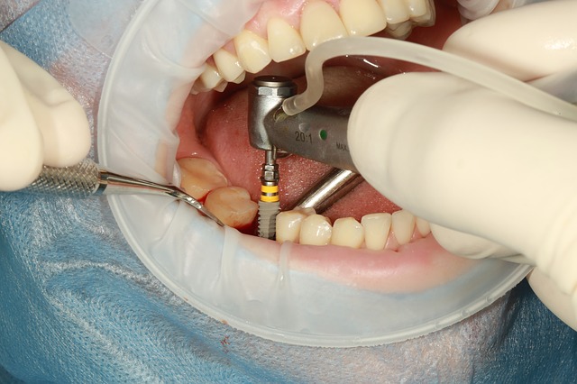 dental implantology