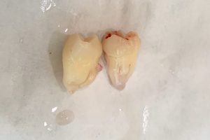 oral and maxillofacial surgery
