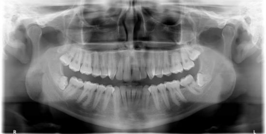 oral and maxillofacial surgery