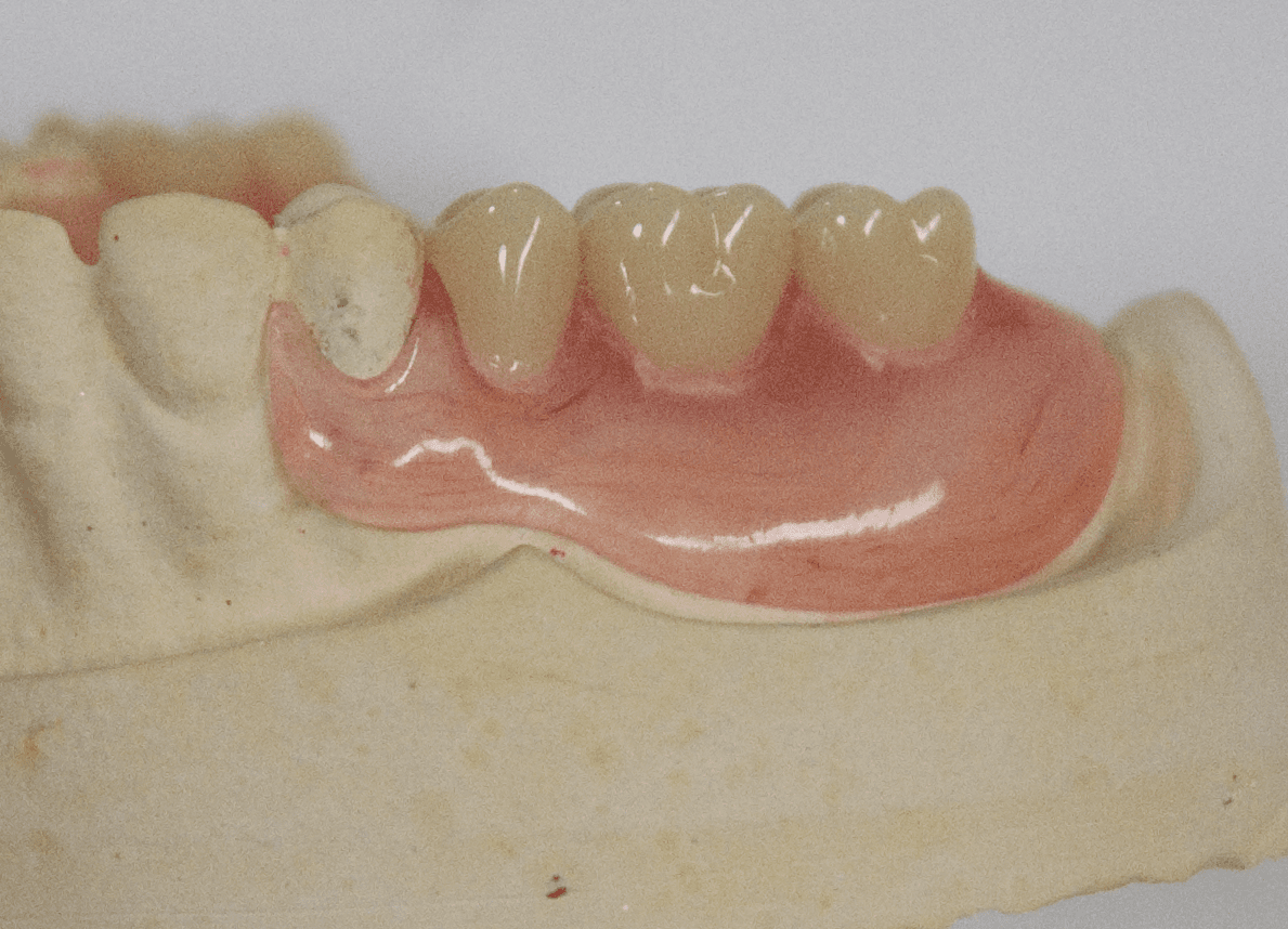 prosthodontics