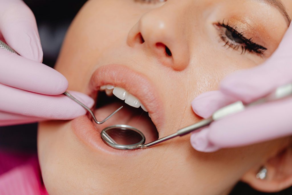 dental check up